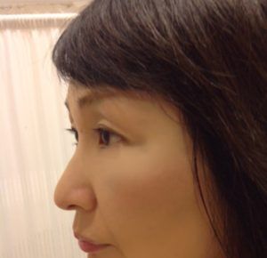 fullsizerender-25